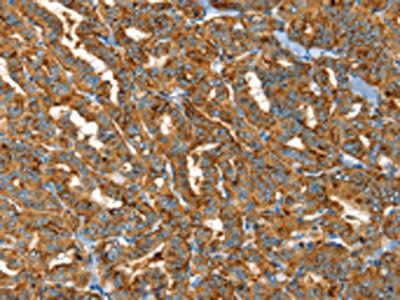 PTPN3 Antibody