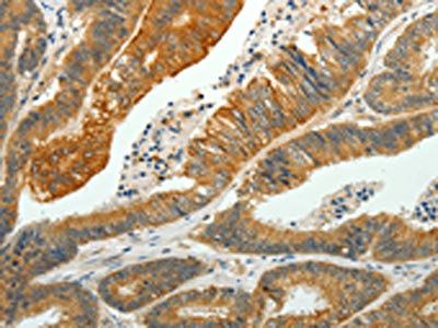 PTPN6 Antibody