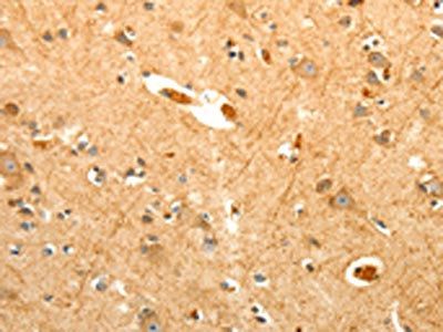PTPN6 Antibody