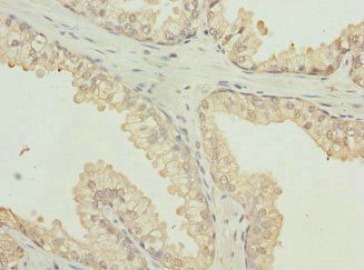 PTPRB antibody