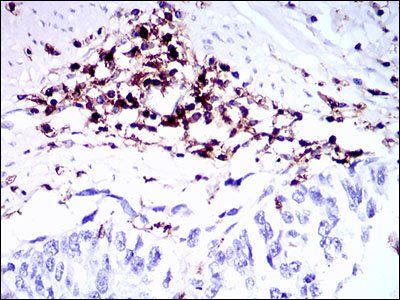 PTPRC Antibody