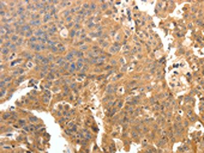 PTPRE Antibody