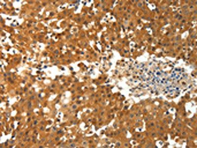 PTPRE Antibody
