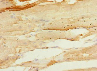 PTPRO Antibody