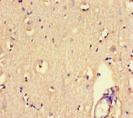 PTPRS Antibody
