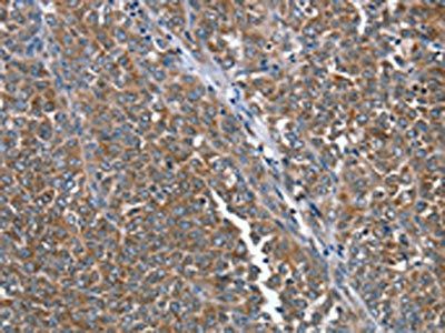 PTRH2 Antibody