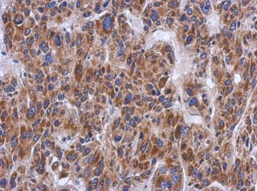 PTS antibody [N1C3]