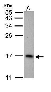 PTS antibody [N1C3]