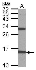 PTS antibody [N1C3]