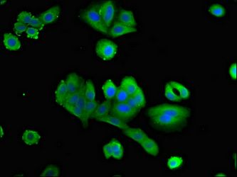 PTX3 antibody