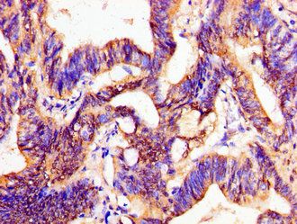 PTX3 Antibody