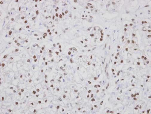 PUF60 antibody