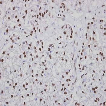 PUF60 Rabbit Polyclonal Antibody