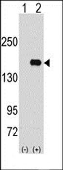PUM2 antibody