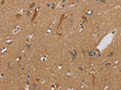 PUS10 Antibody