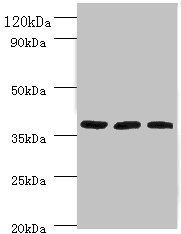 Putative tRNAcytidine(32)/guanosine(34)-2'-O)-methyltransferase antibody