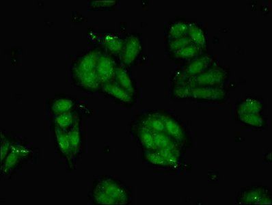 PVALB Antibody