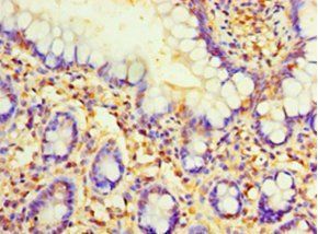 PVALB Antibody