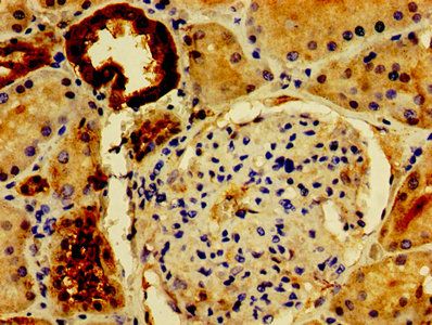PVALB Antibody