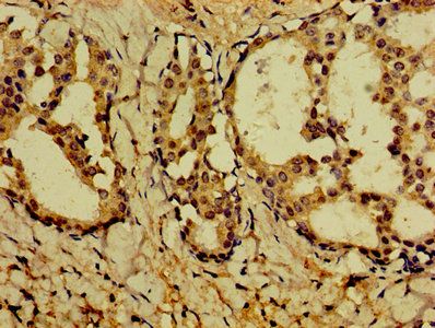 PVALB Antibody