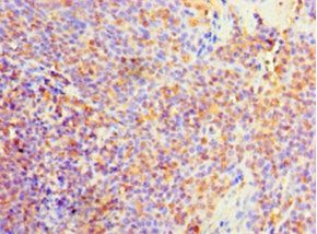 PVALB Antibody