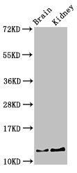 PVALB Antibody