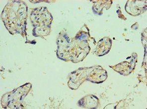PVR Antibody