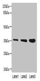 PVRIG antibody