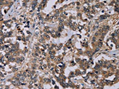 PVRL4 antibody