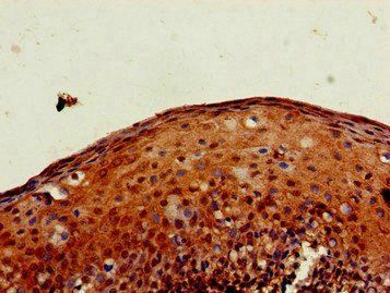 PXK Antibody