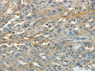 PXN Antibody