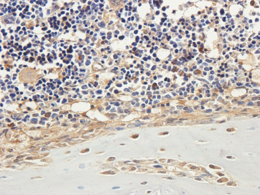 PYCR1 antibody