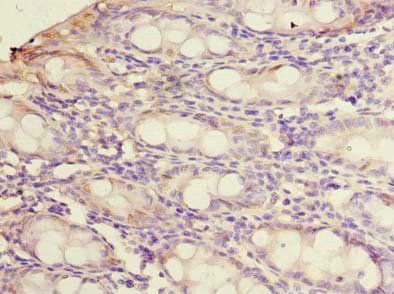 PYCR2 Antibody