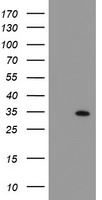 PYCR3 Antibody