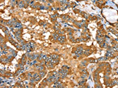 PYGL Antibody