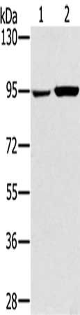 PYGL antibody