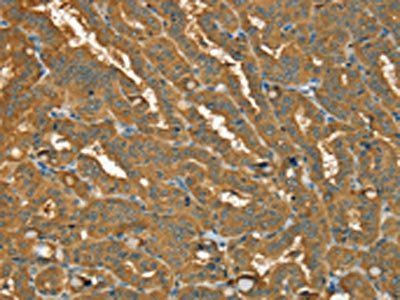 PYGL Antibody