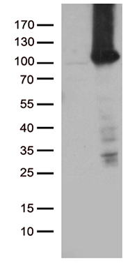 PYGM Antibody
