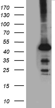 PYGM Antibody