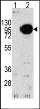 PYGM antibody