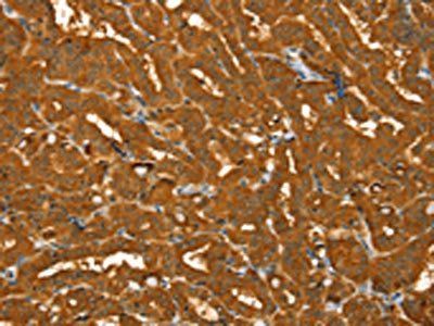 PYGM Antibody