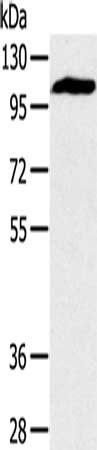PYGM Antibody