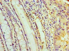 Pyrroline-5-carboxylate reductase 1, mitochondrial antibody