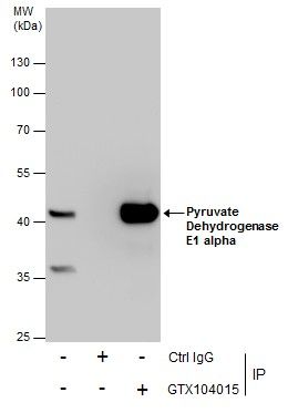 Pyruvate Dehydrogenase E1 alpha antibody