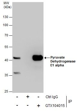 pyruvate dehydrogenase E1 alpha 1 subunit Antibody