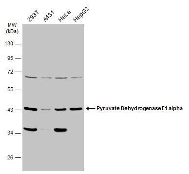 Pyruvate Dehydrogenase E1 alpha antibody