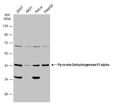 pyruvate dehydrogenase E1 alpha 1 subunit Antibody