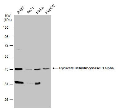 pyruvate dehydrogenase E1 alpha 1 subunit Antibody