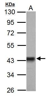Pyruvate Dehydrogenase E1 alpha antibody