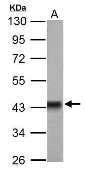 pyruvate dehydrogenase E1 alpha 1 subunit Antibody